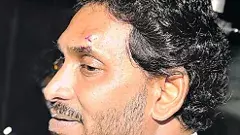 సీఎం జగన్‌పై రాయిదాడిలో పోలీసుల ఘోర వైఫల్యం