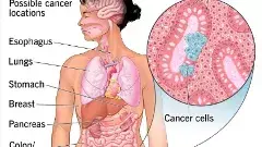 క్యాన్సర్, గుండె పోటుపై ఇంటింటా పరీక్షలు