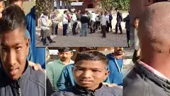 Bald Hair | బుల్దానా జిల్లా 11 గ్రామాలవాసులకు బట్టతల, ఎందుకంటే...