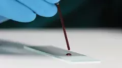 Meerpet Murder | ఒక్క రక్తపు చుక్క హంతకుడిని  పట్టించింది...