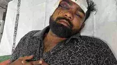 తిరుపతి: దళిత విద్యార్థిపై దాడి వెనుక కథేమిటి?