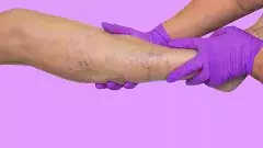 అగ్రరాజ్యం అధ్యక్షుడు ట్రంప్‌నకు CVI..