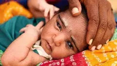 దేశంలో తగ్గిన శిశు మరణాల రేటు..