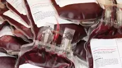 జార్ఖండ్: తలసేమియా బాధితులకు సోకిన హెచ్ఐవీ