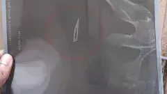 రమాదేవి తొడలో సర్జికల్ బ్లేడు