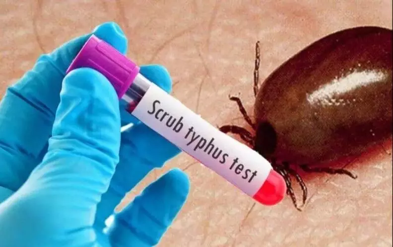 కృష్ణా జిల్లాలో స్క్రబ్ టైఫస్ కలకలం కృష్ణా జిల్లాలో స్క్రబ్ టైఫస్ కలకలం