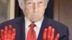 ట్రంపూ, ఈ 20 రోజుల పసిగుడ్డును చంపేందుకు నీకు చేతులెలా వచ్చాయ్?